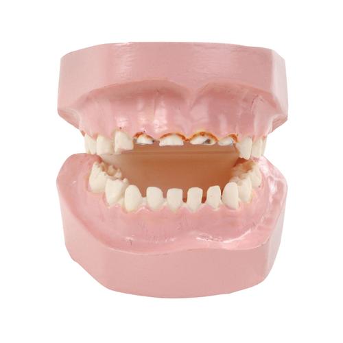Baby Bottle Tooth Decay Model, 1018302 [W43157], Parenting Education