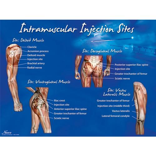 Intramuscular Injection Sites Poster, 1018427 [W44783], Injections and Punctures