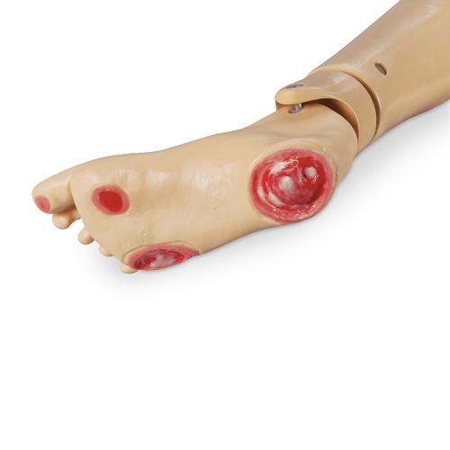 Geri and KERi Pressure Ulcer Foot, 1017985 [W44784F], Options