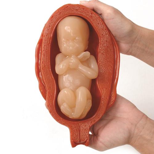 Uterus/Fetus Model Set (5), 3004840 [W99999-509], Women's Health Education