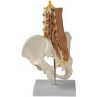 Pelvic Model with Lumbar Spine Muscles, 1019418, Modelos de Columna vertebral