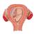 Fetus Model, 3rd Month - 3B Smart Anatomy, 1000324 [L10/3], Human (Small)