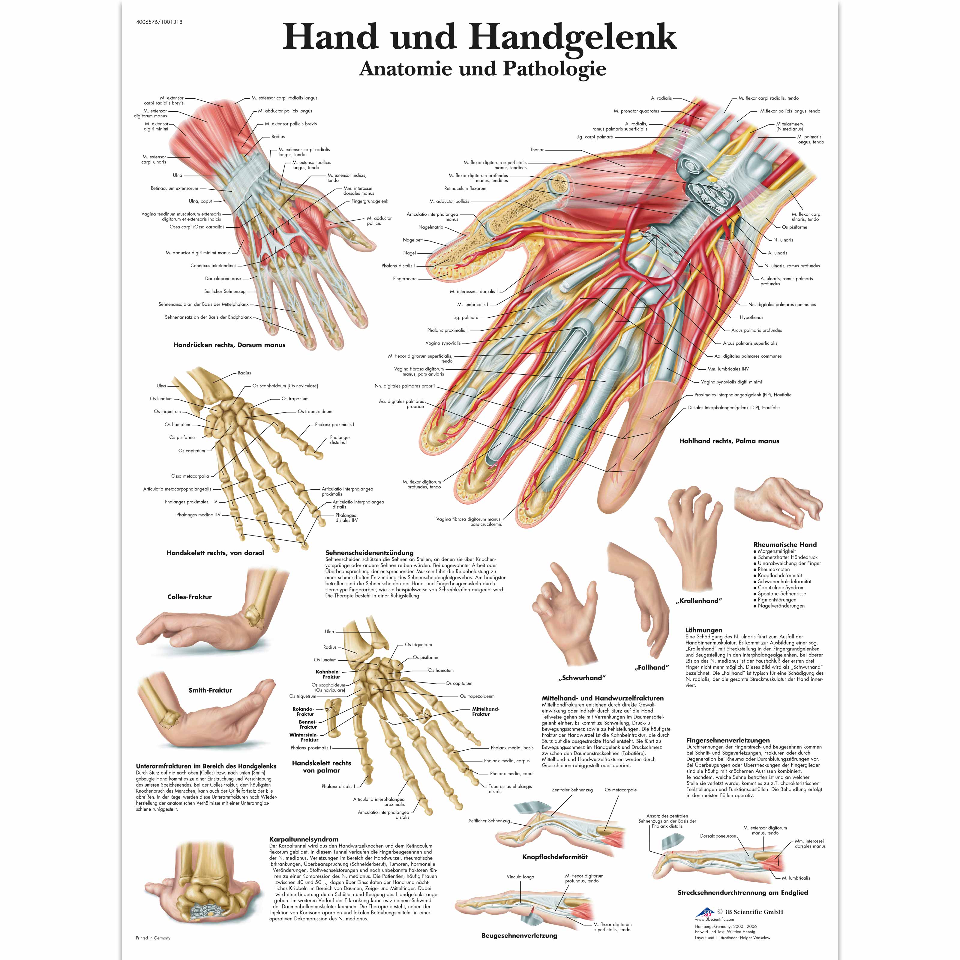 Hand Und Handgelenk Anatomie Und Pathologie Vr0171uu Skeletal System 3b Scientific
