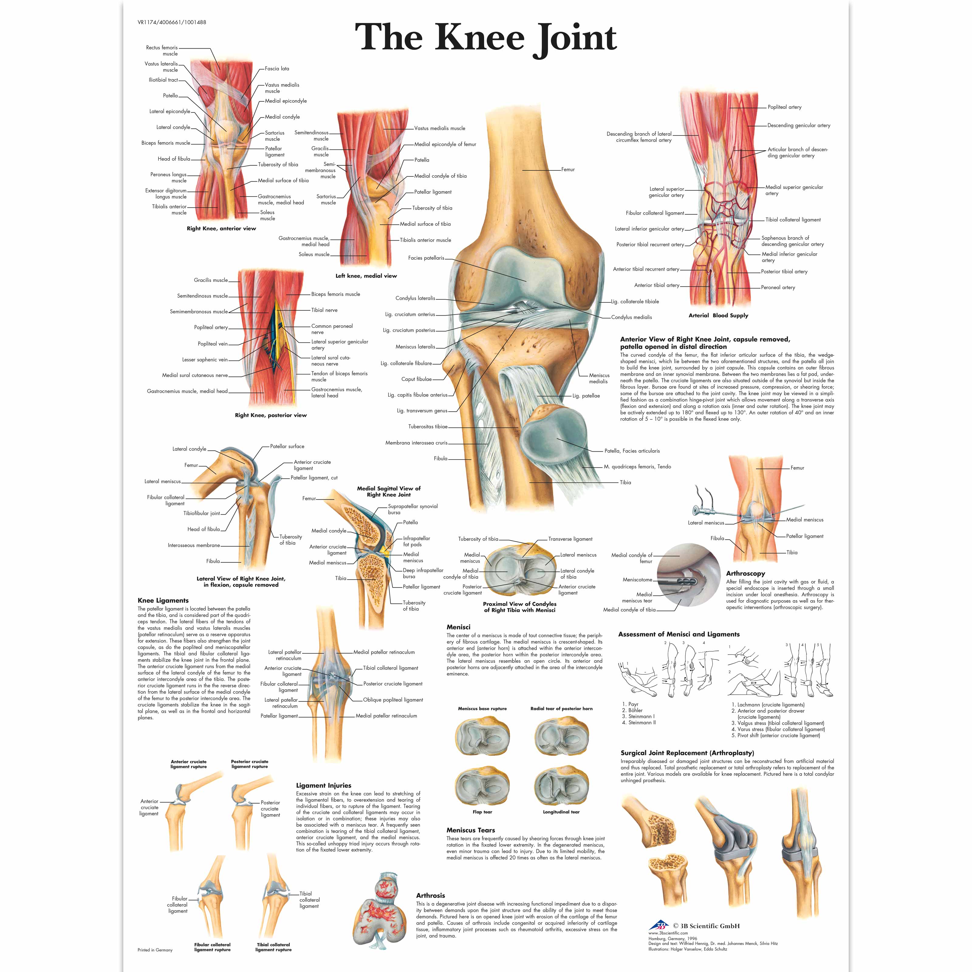 Anatomical Charts and Posters | Anatomy Charts | Arm and Leg Charts