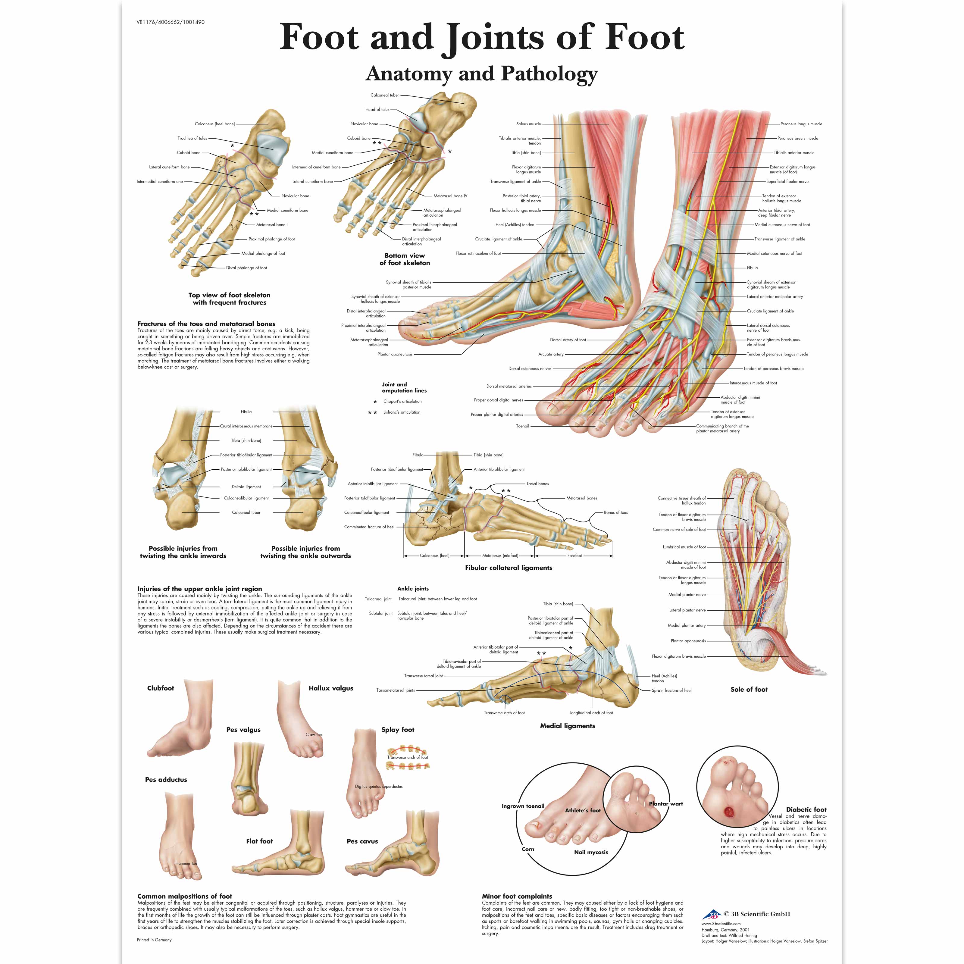 Foot Symptom Chart