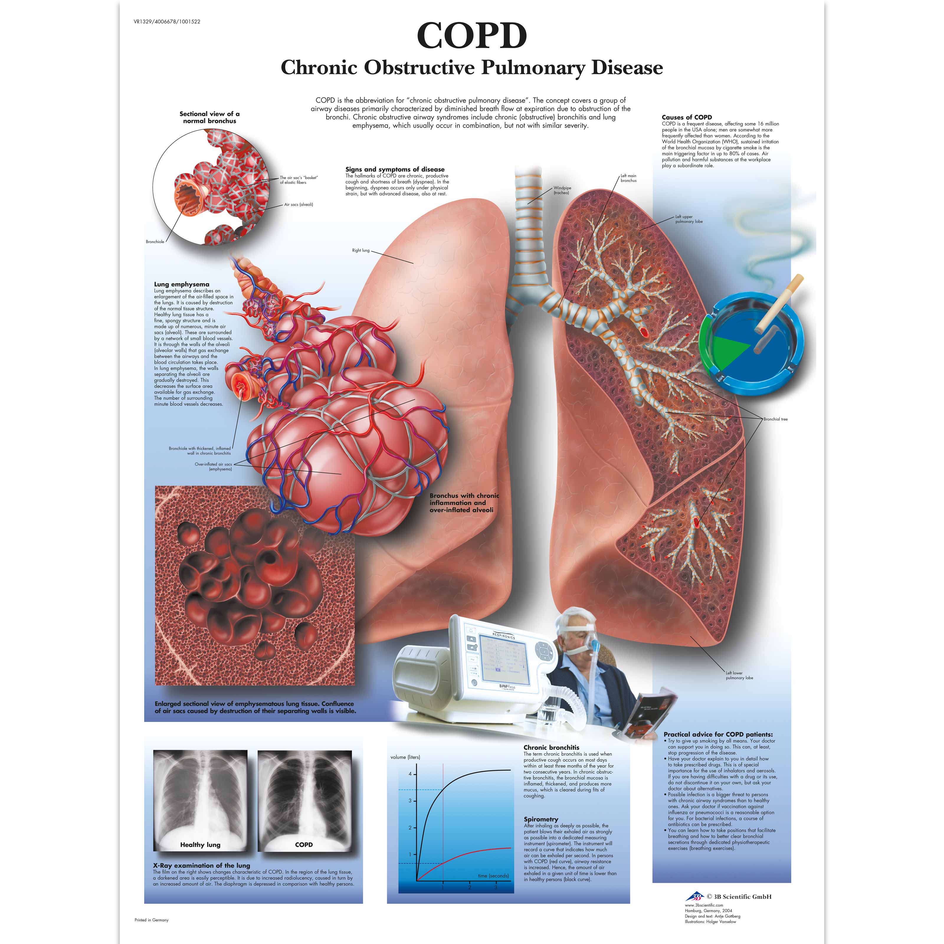 copd assessment test