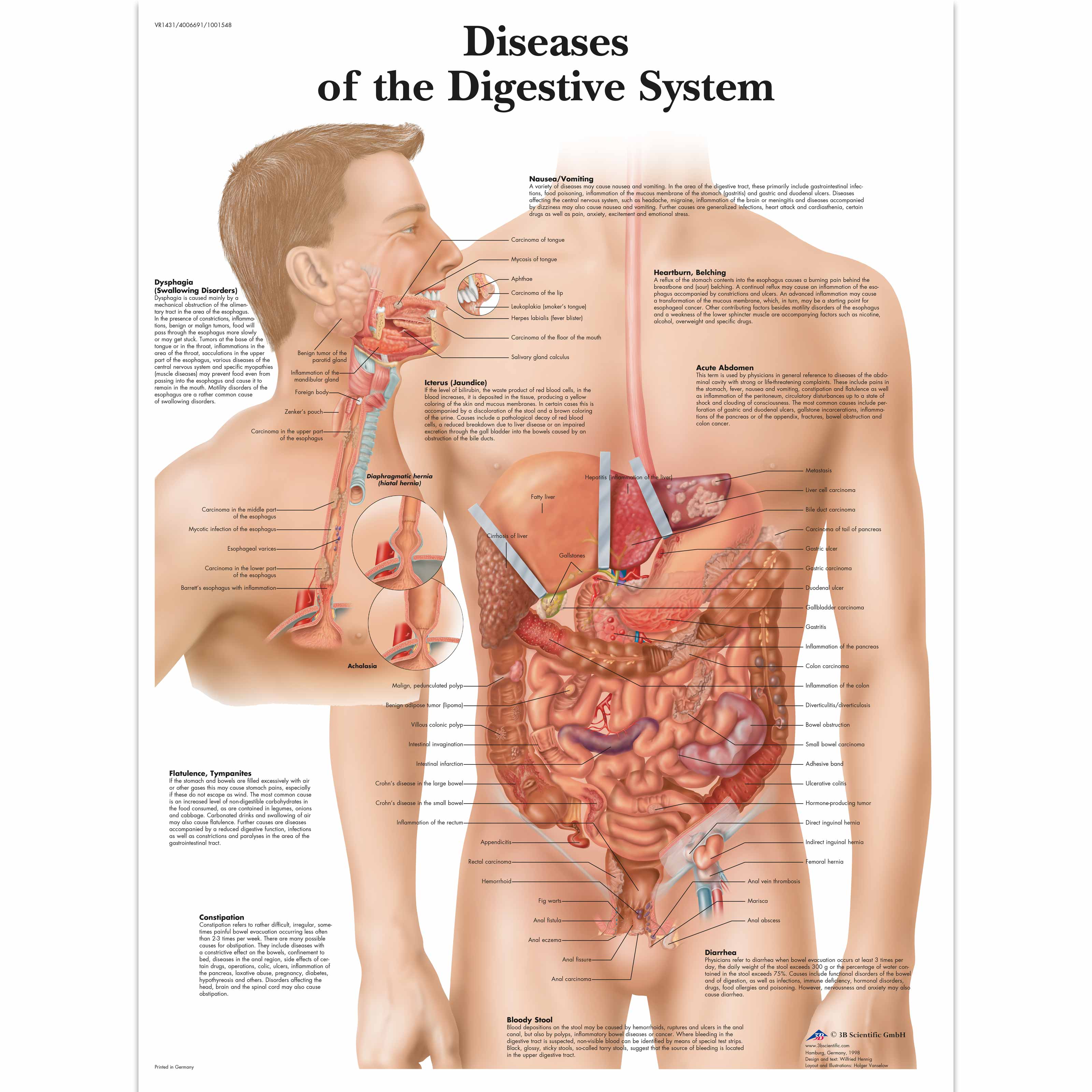 The Skin And Common Disorders Anatomical Chart