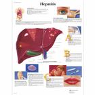 Hepatits, 4006693 [VR1435UU], Sistema metabólico