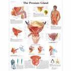 The Prostate Gland, 4006700 [VR1528UU], Sistema Urinario