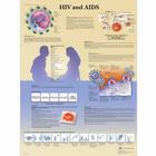 HIV and AIDS Chart, 4006722 [VR1725UU], Parasitic, Viral or Bacterial Infection