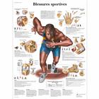 Blessures sportives, 4006746 [VR2188UU], Muscle