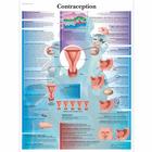 Contraception, 4006790 [VR2591UU], Pregnancy and Childbirth