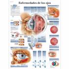Enfermedades de los ojos, 4006829 [VR3231UU], Ophthalmology