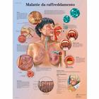 Malattie da raffreddamento, 4006918 [VR4253UU], Respiratory System