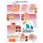 Câncer de Pele, 1002155 [VR5295L], Cancers