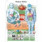 Diabete melito, 50x67 cm, Laminado, 1002167 [VR5441L], Metabolic System