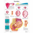 Gravidez, 50x67 cm, Laminado, 1002177 [VR5554L], Pregnancy and Childbirth