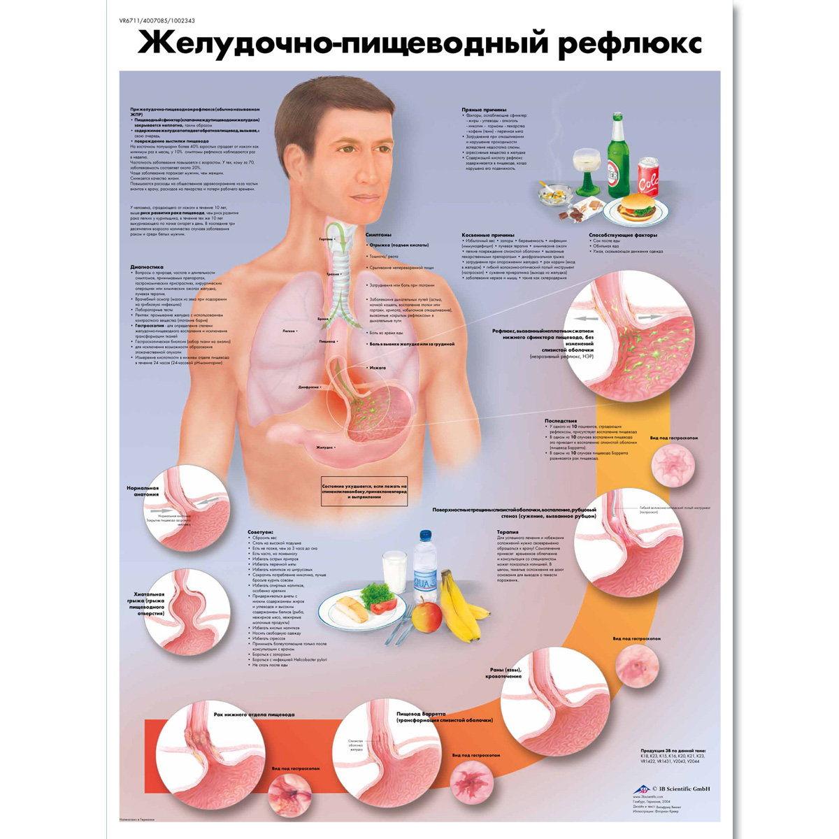 Gastroesophageal reflux disease Chart - 1002343 - VR6711L ...