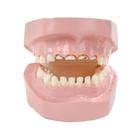 Modelo de deterioro dental por "caries del biberón", 1018302 [W43157], Educación para padres