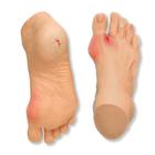Common Foot Problems Model, 3004419 [W44729], Herramientas educativas para diabetes