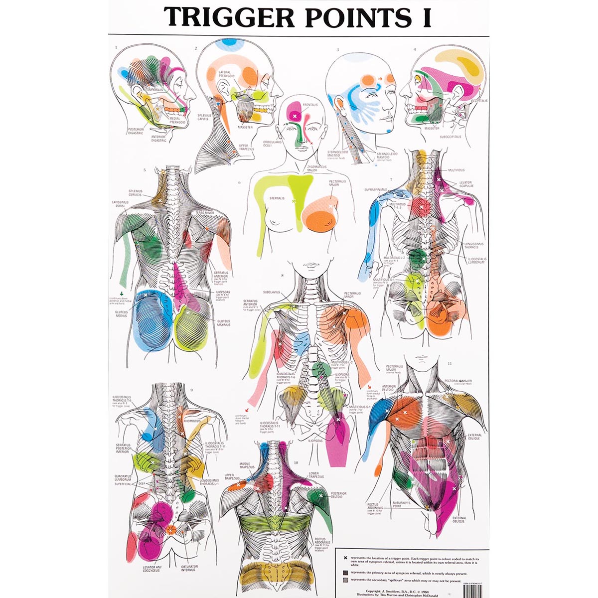 Trigger Point Referred Chart